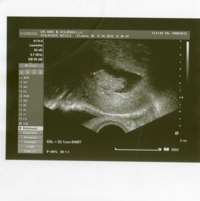 Bild zu zurück vom Arzt und weiß endlich wie weit ich bin + Bild - Forum für März - Mamis