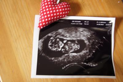 Bild zu Wieder zurück ;0) und endlich ein Bildchen... - Forum für März - Mamis