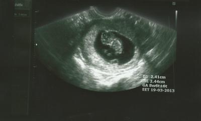 Bild zu Bildchen... - Forum für März - Mamis