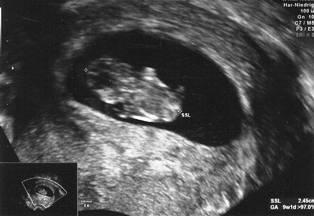 Bild zu Hier noch die versprochenen US Bilder - Forum für März - Mamis