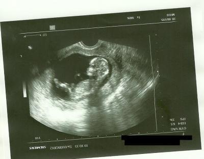 Bild zu War gestern im Krankenhaus! +Foto - Forum für März - Mamis