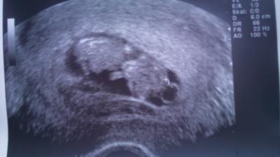 Bild zu Hallo .. wollt mich nochmal melden mit foto ;) - Forum für März - Mamis