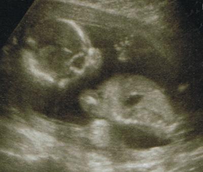 Bild zu neu dabei - Forum für März - Mamis