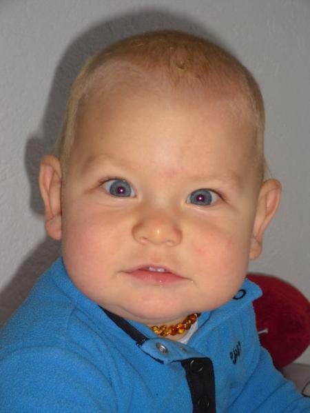 Bild zu