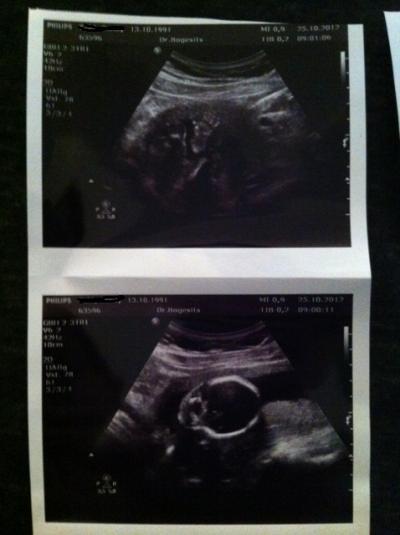 Bild zu Bilder vom Ultraschall gleich 3 stück. - Forum für März - Mamis