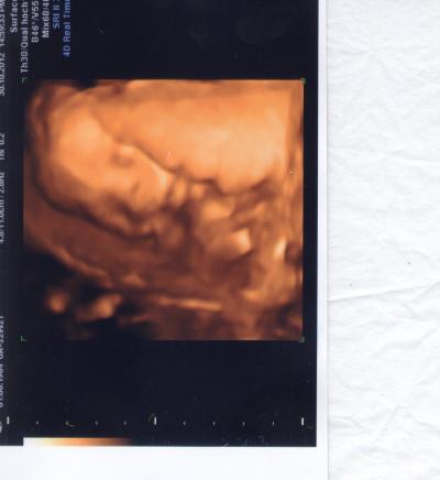 Bild zu Gestern FD, 4D-Bild und jetzt 2 Wochen krank gechrieben - Forum für März - Mamis