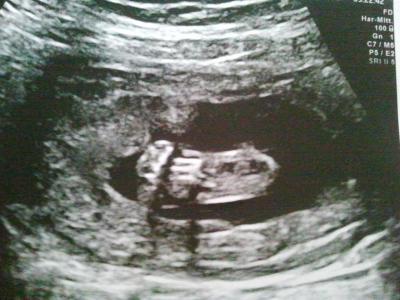 Bild zu Heute FA-Termin ;) - Forum für März - Mamis