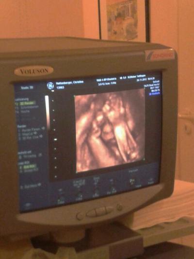 Bild zu 3d ultraschall < 3 und der kleine wollte nicht. - Forum für März - Mamis