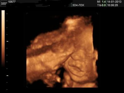 Bild zu VU heute mit 3D Foto - Forum für März - Mamis