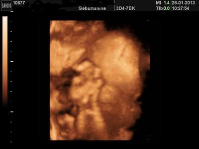 Bild zu VU mit 3D-Bildle - Forum für März - Mamis