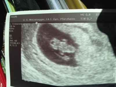 Bild zu Zurück von Gyn - Forum für März - Mamis