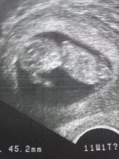 Bild zu meine letzten wochen... - Forum für März - Mamis