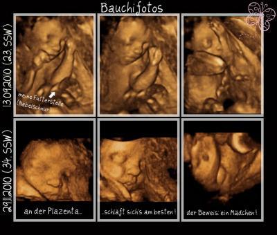 Bild zu Wer lässt aller 3D machen? - Forum für März - Mamis