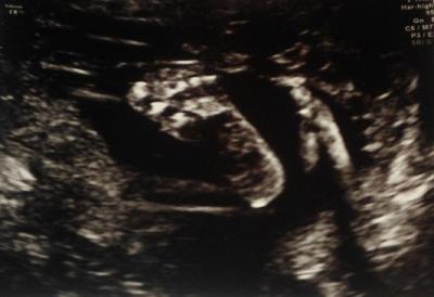 Bild zu ein mal etwas anderes Baby-Bild von Feindiagnostik - Forum für März - Mamis