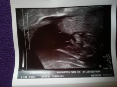 Bild zu EINDEUTIG ♥ - Forum für März - Mamis