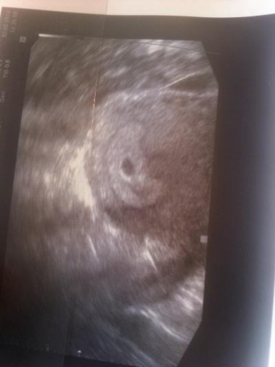 Bild zu So ein komisches vibrieren in schambereich... - Forum für März - Mamis