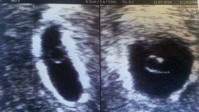 Bild zu kleine Erleichterung - Forum für März - Mamis