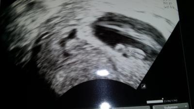 Bild zu Unser Krümel - Forum für März - Mamis
