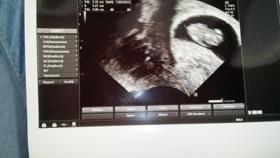 Bild zu Wieder daaaaa :-) - Forum für März - Mamis