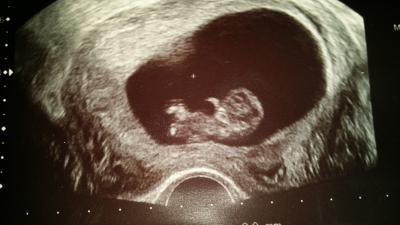 Bild zu Ich bin auch mal wieder da :-) mit Fotooooo :-) - Forum für März - Mamis