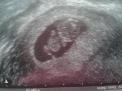 Bild zu 10. ssw und fa Termin - Forum für März - Mamis