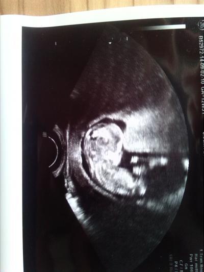 Bild zu wieder da ..... - Forum für März - Mamis