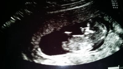 Bild zu Mal wieder ein Schreck bekommen... - Forum für März - Mamis