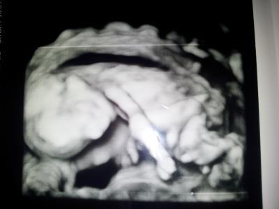 Bild zu So zurück aus der Klinik happy ;) - Forum für März - Mamis