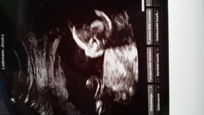 Bild zu Ultraschallbild + Outing :-) - Forum für März - Mamis