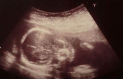 Bild zu hier noch 2 bildchen von gestern ;) - Forum für März - Mamis