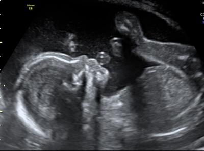 Bild zu Zurück vom 2. großen US :-) - Forum für März - Mamis