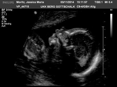 Bild zu Gestern FD - Forum für März - Mamis