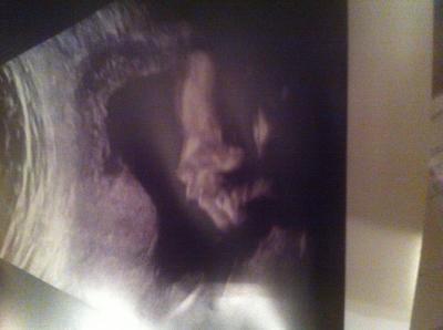 Bild zu Outing ganz vergessen - Forum für März - Mamis