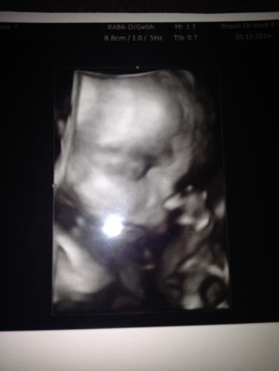 Bild zu Zurück von der Vorsorge! - Forum für März - Mamis