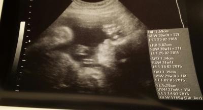 Bild zu Auch zurück vom letzten Screening und CTG ....Größe & Gewicht!? - Forum für März - Mamis