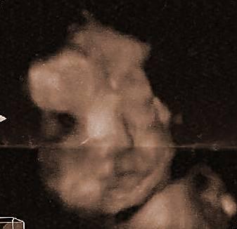 Bild zu HILFE !! Immer noch keinen Namen - Forum für März - Mamis