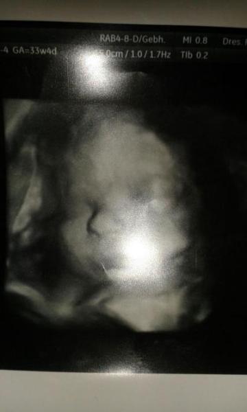 Bild zu bild - Forum für März - Mamis