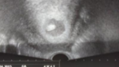 Bild zu Angst :/ - Forum für März - Mamis