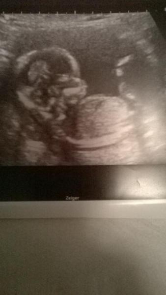 Bild zu Ich wollte euch hier mal meinen Bauchbewohner zeigen :) Bilderrunde :) - Forum für März - Mamis