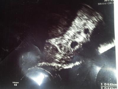 Bild zu Hallo, hier mal was für die Neugierien von uns.... - Forum für März - Mamis