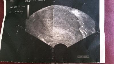 Bild zu foto bei 5+2 gestern - Forum für März - Mamis