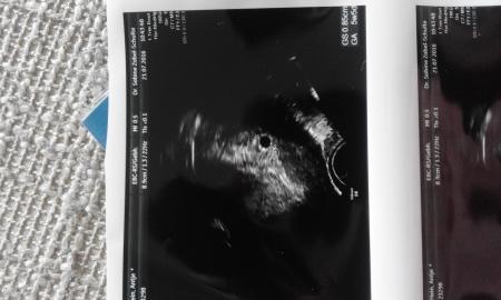 Bild zu Zurück vom FA - Forum für März - Mamis