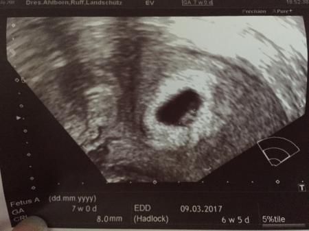 Bild zu Das Herzchen schlägt :) - Forum für März - Mamis