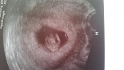 Bild zu fotos - Forum für März - Mamis