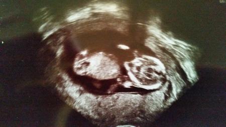 Bild zu US-Termin gehabt! - Forum für März - Mamis