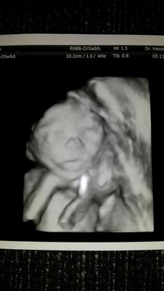 Bild zu Endlich wieder Baby TV - Forum für März - Mamis