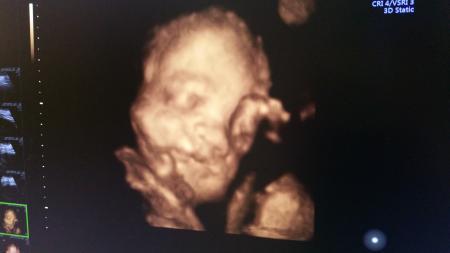 Bild zu Hallo ihr lieben 27 ssw ^_^ plus foto vom Prinzen - Forum für März - Mamis