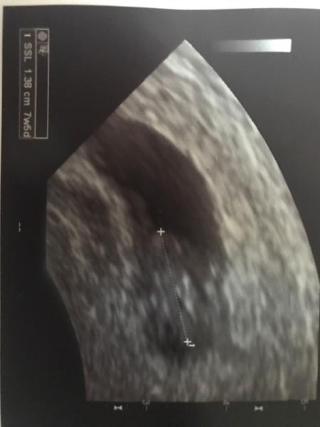 Bild zu Zurück 😍 - Forum für März - Mamis