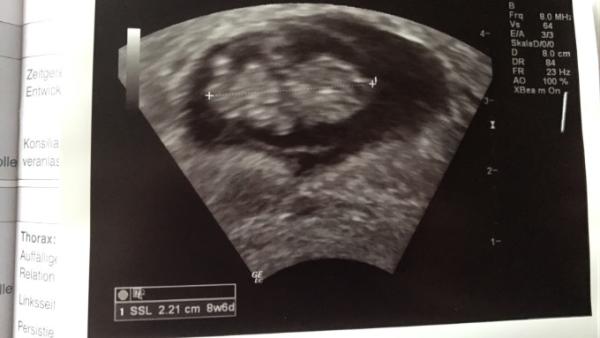 Bild zu Außer planmäßig beim fa... - Forum für März - Mamis