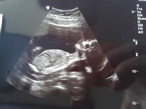 Bild zu War beim Babygucken - Forum für März - Mamis